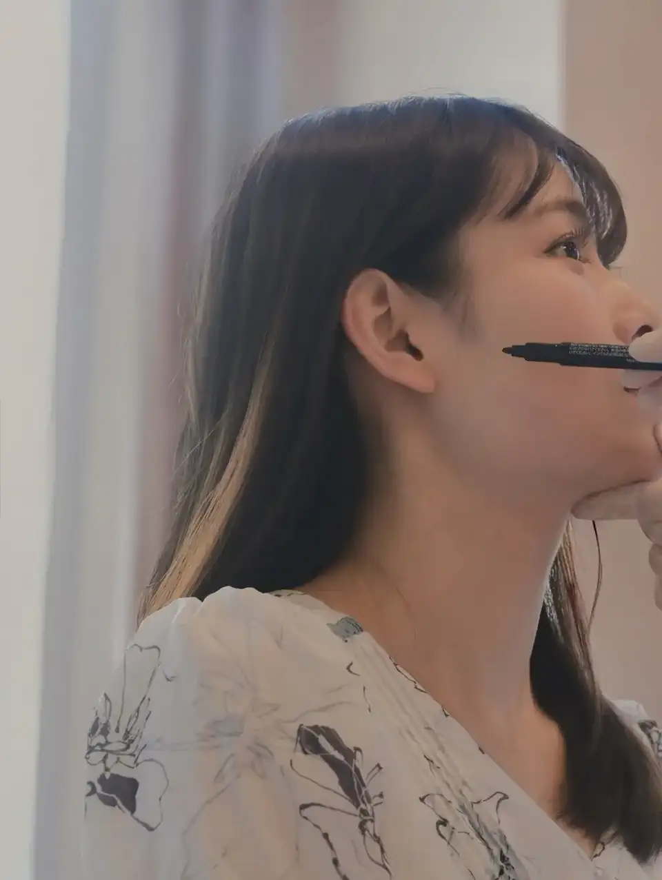 糸リフト（スレッドリフト）:イメージ1